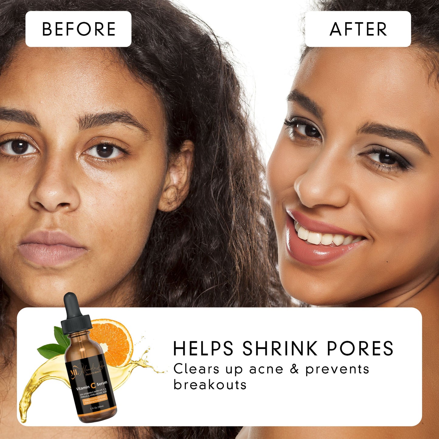 Advanced Anti-Aging Vitamin C Serum